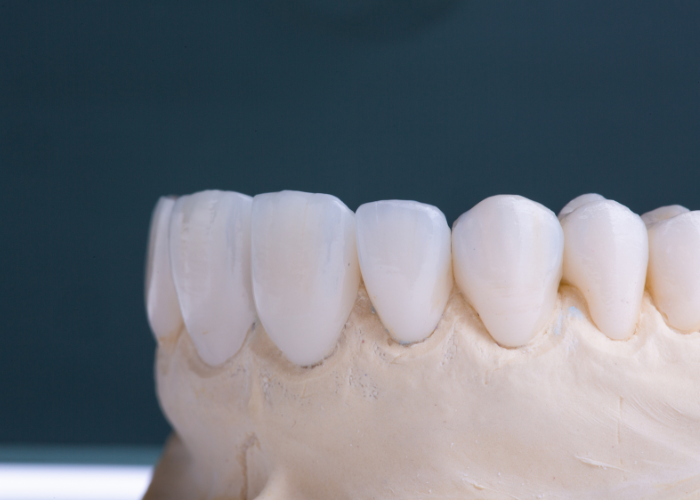 Close-up view of a dental model focusing on the upper front teeth. The model mimics the appearance of natural teeth and gums, with well-aligned teeth exhibiting a natural shape and color.