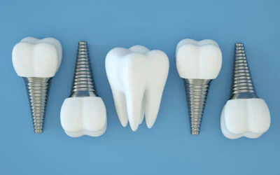 Dental Implant considerations and aftercare at Maldonado Dentistry near St. Petersburg, FL